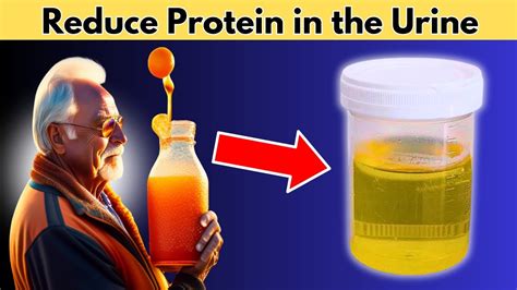 How to Lower Protein in Urine Naturally: Exploring the Connection Between Diet and Kidney Health