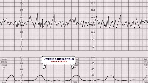 How to Read Contractions on Monitor: A Journey Through the Labyrinth of Modern Technology